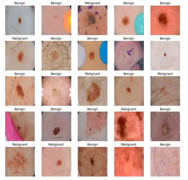 A sample of Benign and Malignant Skin images